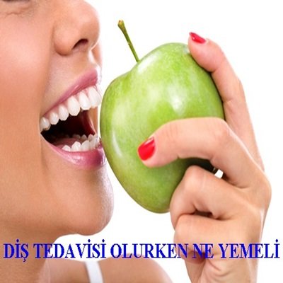 DİŞ TEDAVİSİ OLURKEN NE YEMELİ